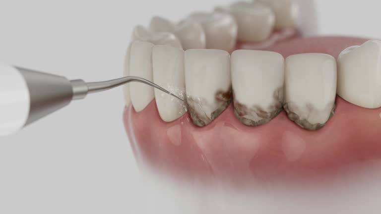 Reliable Tooth Extraction contractor in Hannahs Mill, GA by Smile Center Dentistry
